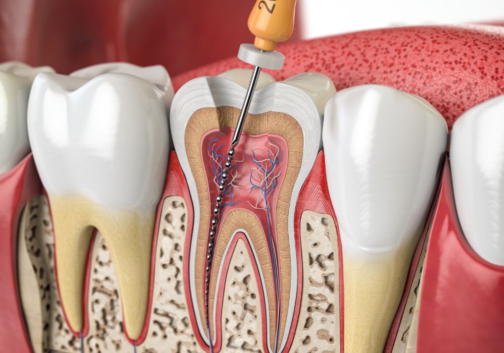 Endodontie